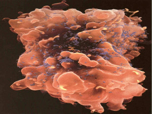 Virus Infected tumor cell