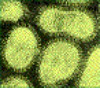 NDV virus electron microscopy