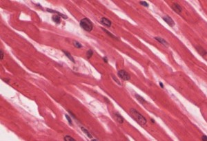 Cardiac muscle tissue is only found in the heart. (OpenStax College © 3.0 Wikimedia Commons)