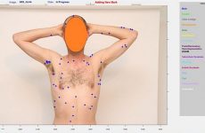 App uses adapted Israeli airforce imaging tech to detect skin cancer