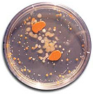 Fight bacteria without antibiotics