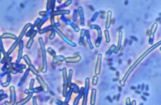 Revolutionary antibiotic against anthrax
