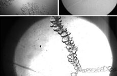 ISRAELI RESEARCH: CELL PHONE RADIATION MAY CAUSE VISUAL DAMAGE