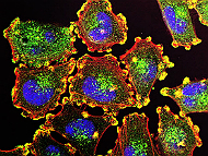 Israel and Cancer